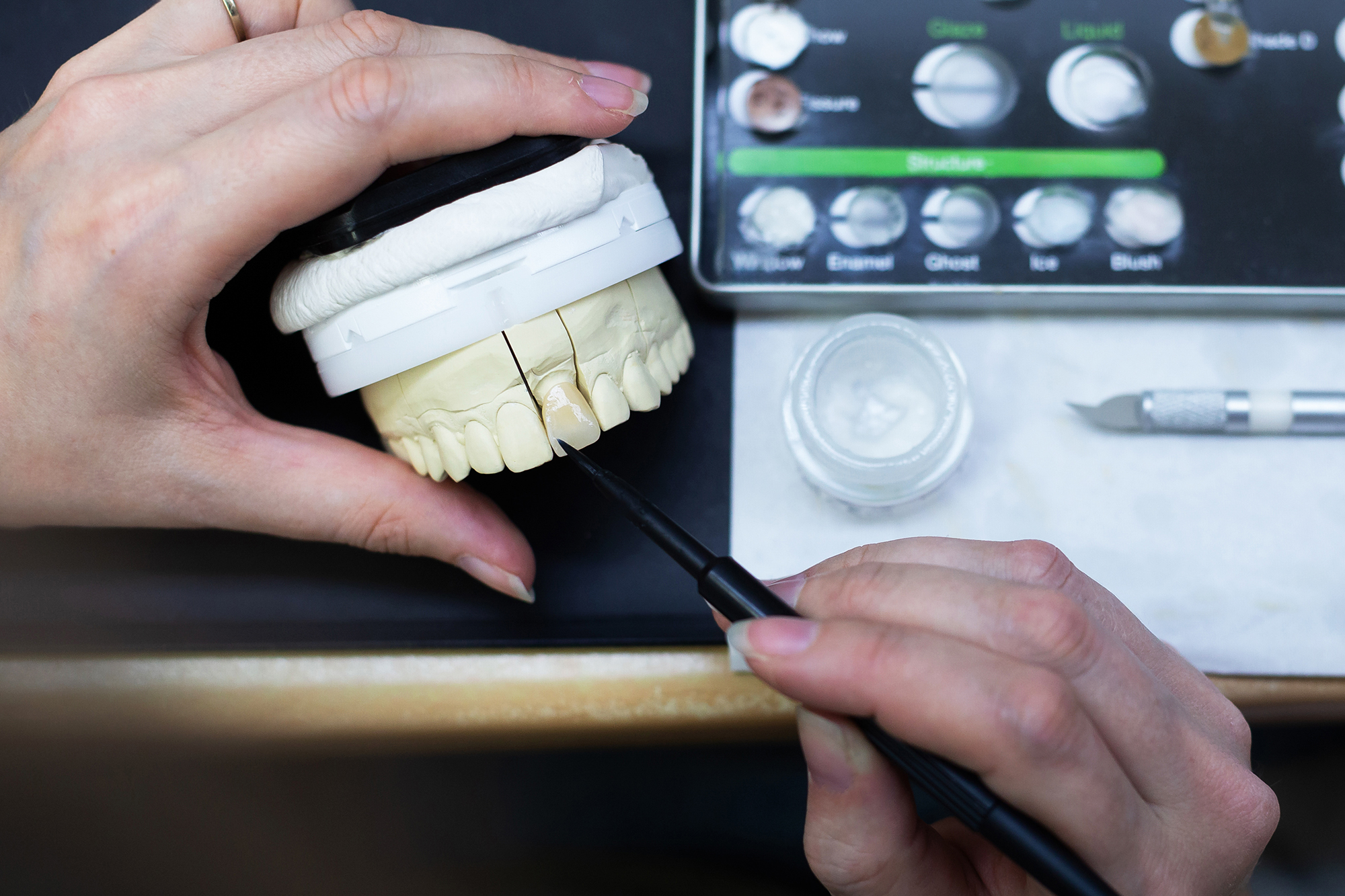 Arbeitsschritte im Dentallabor, Färben eines künstlichen Zahnes, Fotografie Unternehmensportrait Dentallabor Kastner