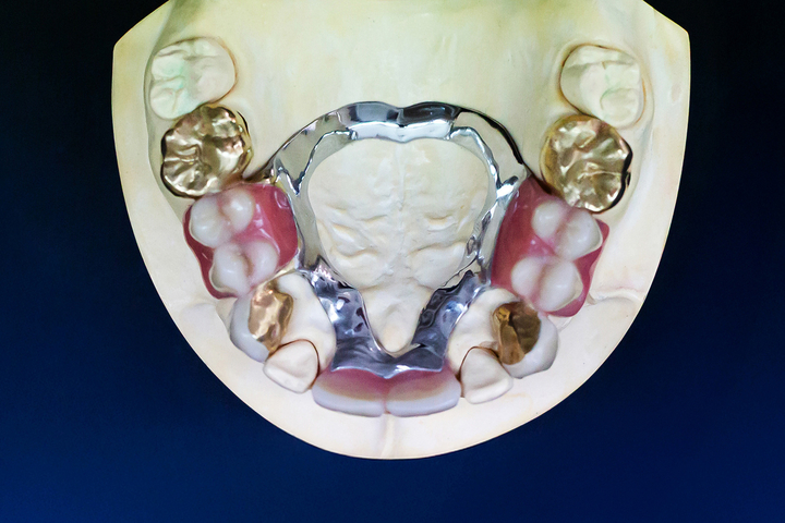 Produktion im Dentallabor, Nahaufnahme, Fotografie Unternehmensportrait Dentallabor Kastner
