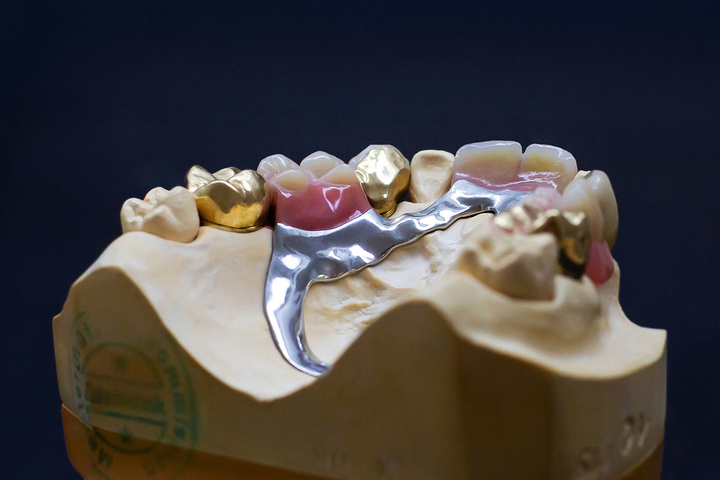 Produktion im Dentallabor, Nahaufnahme, Fotografie Unternehmensportrait Dentallabor Kastner